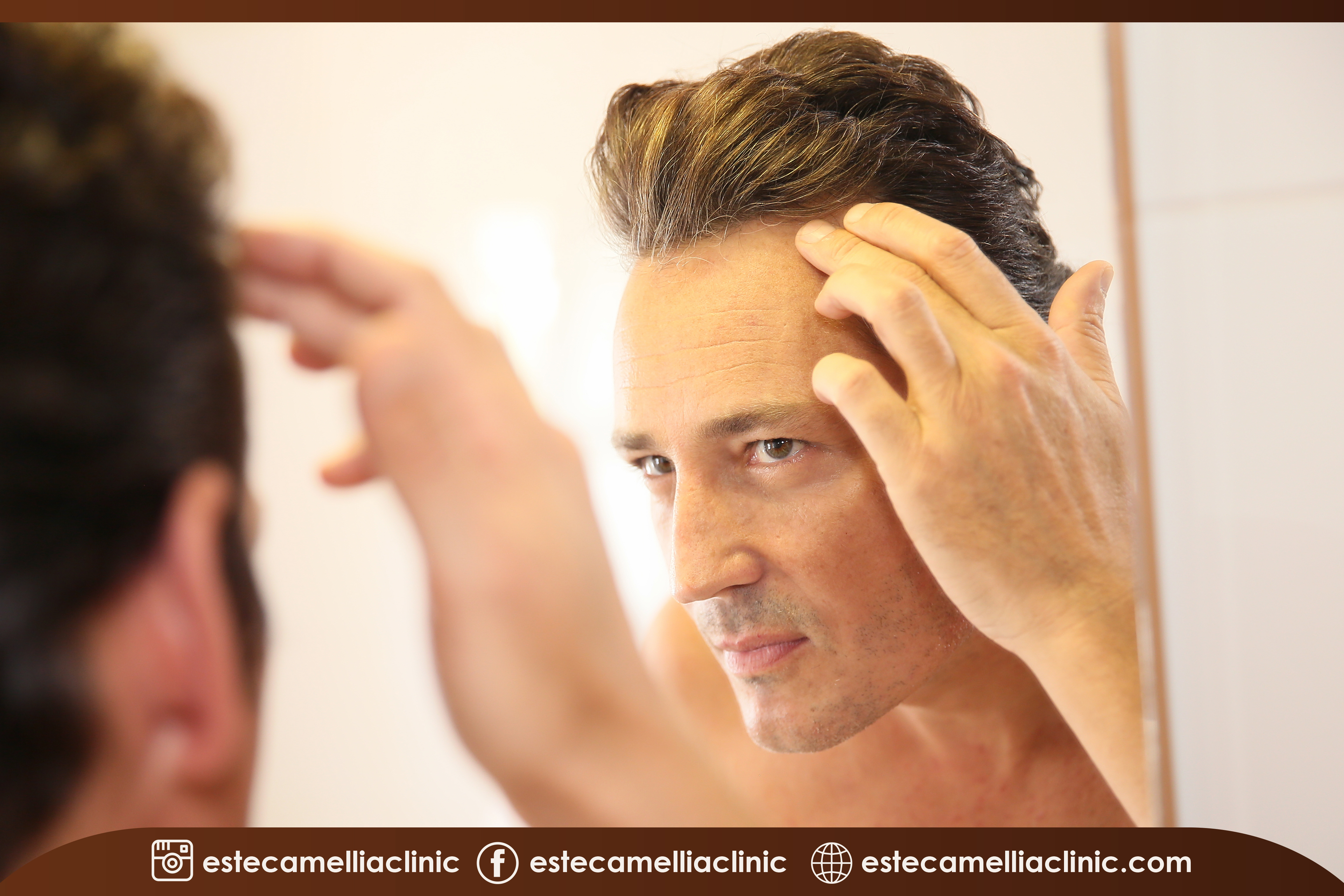 Trapianto di capelli Dhi