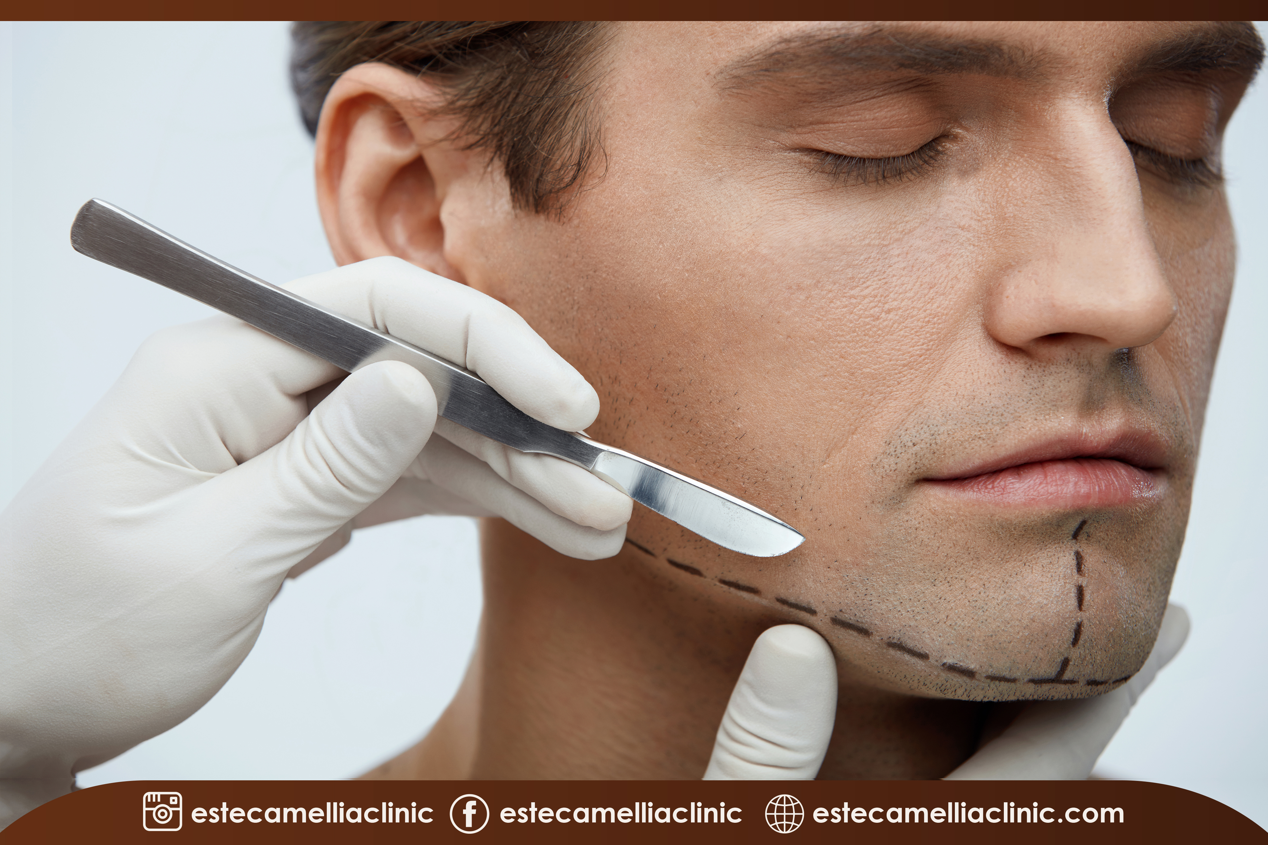 Dhı/Fue Sakal Ekimi